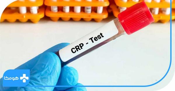 CRP در آزمایش خون چیست,میزان نرمال آزمایش CRP در بزرگسالان