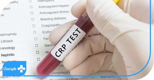 CRP در آزمایش خون چیست,تفسیر آزمایش CRP