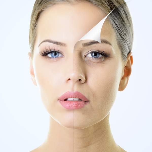 لایه برداری مکانیکی پوست صورت,لایه برداری پوست صورت,لایه برداری پوست صورت با لیزر