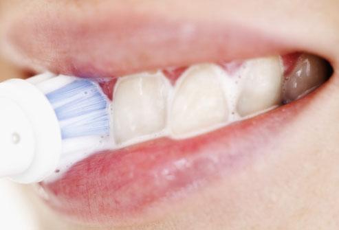 ترفندهای خانگی برای سلامت دندان,سلامت دندان,حذف لکه‌های سطحی دندان,راهکار خانگی سفید کردن دندان‌ها,کیت سفید کننده دندان