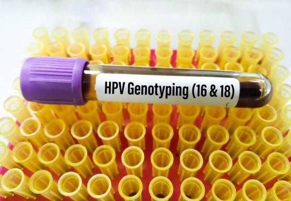 آزمایش HPV برای زنان: آنچه باید بدانید