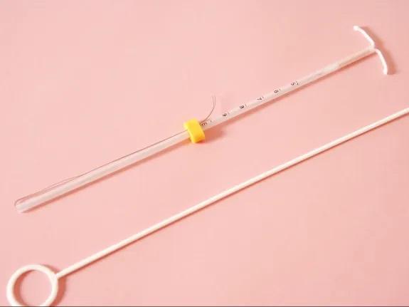 وسایل موردنیاز نصب آی یو دی IUD