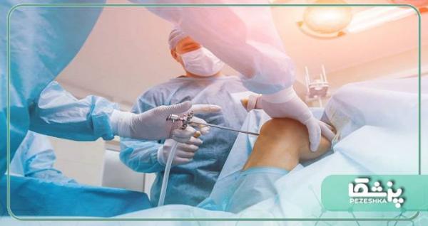 هدف از جراحی تعویض مفصل زانو چیست؟