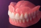 دندان مصنوعی,دندان مصنوعی ثابت,عکس دندان مصنوعی