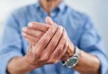 علائم آرتروز انگشتان دست,تمرین مخصوص آرتروز انگشت,درمان آرتروز انگشتان دست با ورزش