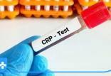 CRP در آزمایش خون چیست,میزان نرمال آزمایش CRP در بزرگسالان