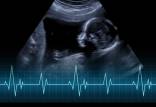 تشکیل نشدن قلب جنین,علت تشکیل نشدن قلب جنین چیست,علل تشکیل نشدن قلب جنین