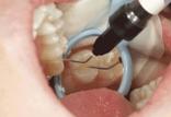 دهان و دندان,راز سلامتی دندان,علت درد دندان