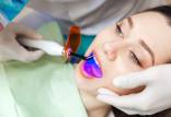 سفید کردن دندان‌ها,وایتینگ دندان,انواع روش های دندانپزشکی سفید کردن دندان