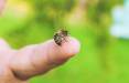 درمان نیش زنبور,روش های درمان نیش زنبور