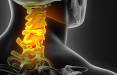 درمان دیسک گردن با ورزش,حرکات ورزشی برای درمان دیسک گردن