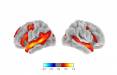 How Our Brain Produces Language and Thought, According to Neuroscientists - The New York Times