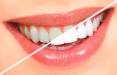سفید کردن دندان,روش سفید کردن دندان,سفید کردن دندان به روش گیاهی