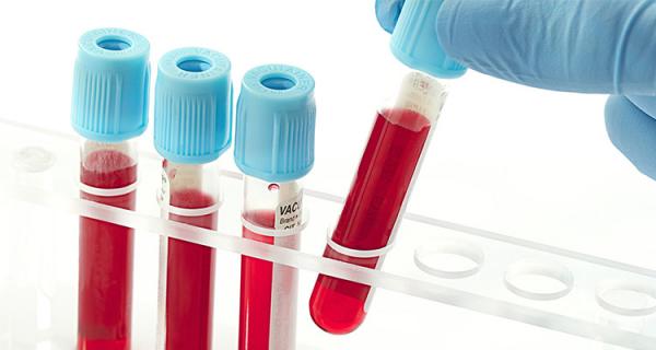 آزمایش خون از آزمایش های دوران بارداری,آزمایش های دوران بارداری در سه ماه اول,آزمایش های دوران بارداری