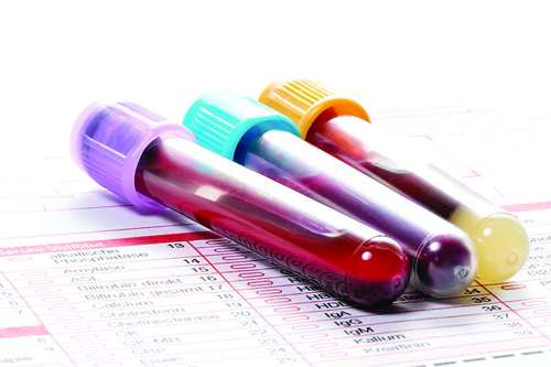 آزمایش خون, نتایج آزمایش خون,نحوه خواندن جواب آزمایش خون
