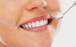 کامپوزیت دندان,کامپوزیت دندان چیست,کاربرد کاپوزیت دندانی