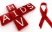 ویروس ایدز,علائم ویروس ایدز,ویروس اچ‌آی‌وی,نکاتی برای زندگی با مبتلایان به ایدز,روزنه های درمان ایدز