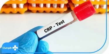 CRP در آزمایش خون چیست,میزان نرمال آزمایش CRP در بزرگسالان