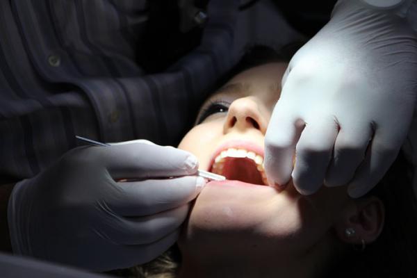 عوارض دندان عقل,دندان عقل,دندان عقل کشیدن