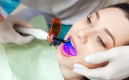 سفید کردن دندان‌ها,وایتینگ دندان,انواع روش های دندانپزشکی سفید کردن دندان