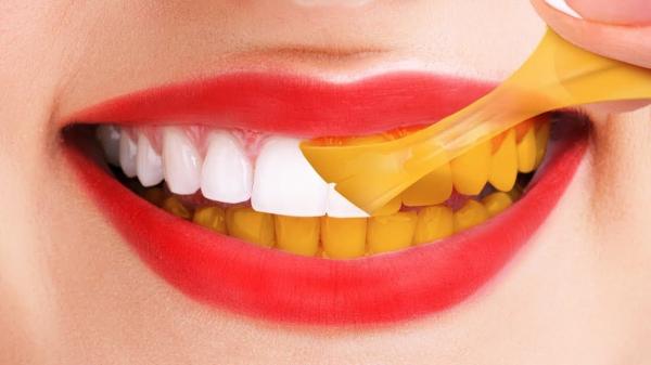 درمان های خانگی زرد شدن دندان